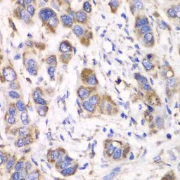 Anti-ALDH2 antibody used in IHC (Paraffin sections) (IHC-P). GTX55502