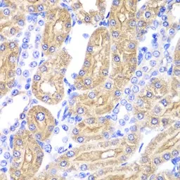 Anti-ALDH2 antibody used in IHC (Paraffin sections) (IHC-P). GTX55502