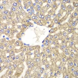 Anti-ALDH2 antibody used in IHC (Paraffin sections) (IHC-P). GTX55502