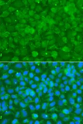 Anti-alpha 1 Antichymotrypsin antibody used in Immunocytochemistry/ Immunofluorescence (ICC/IF). GTX55503