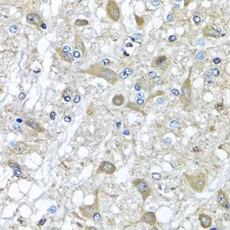 Anti-alpha 1 Antichymotrypsin antibody used in IHC (Paraffin sections) (IHC-P). GTX55503