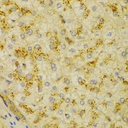 Anti-alpha Actinin 1 antibody used in IHC (Paraffin sections) (IHC-P). GTX55505