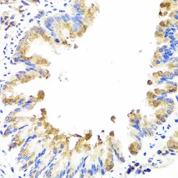 Anti-AMBRA1 antibody used in IHC (Paraffin sections) (IHC-P). GTX55507