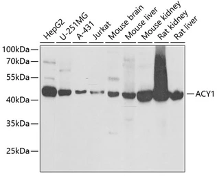Anti-Aminoacylase 1 antibody used in Western Blot (WB). GTX55508