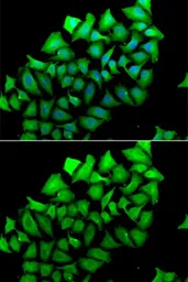 Anti-Aminoacylase 1 antibody used in Immunocytochemistry/ Immunofluorescence (ICC/IF). GTX55508