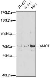 Anti-AMOT antibody used in Western Blot (WB). GTX55509