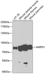 Anti-AMPD1 antibody used in Western Blot (WB). GTX55510