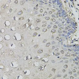 Anti-AMPD1 antibody used in IHC (Paraffin sections) (IHC-P). GTX55510
