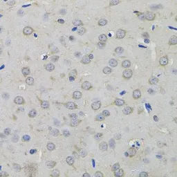 Anti-AMPD1 antibody used in IHC (Paraffin sections) (IHC-P). GTX55510