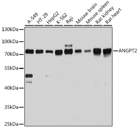 Anti-Angiopoietin 2 antibody used in Western Blot (WB). GTX55512