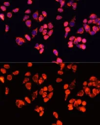 Anti-Angiopoietin 2 antibody used in Immunocytochemistry/ Immunofluorescence (ICC/IF). GTX55512