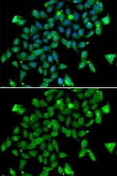 Anti-Aspartoacylase antibody used in Immunocytochemistry/ Immunofluorescence (ICC/IF). GTX55521