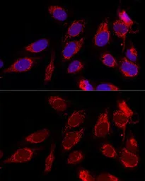 Anti-ATAD3B antibody used in Immunocytochemistry/ Immunofluorescence (ICC/IF). GTX55522