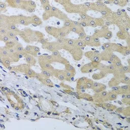 Anti-ATAD3B antibody used in IHC (Paraffin sections) (IHC-P). GTX55522