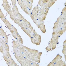 Anti-ATAD3B antibody used in IHC (Paraffin sections) (IHC-P). GTX55522