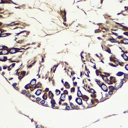 Anti-ATG10 antibody used in IHC (Paraffin sections) (IHC-P). GTX55523