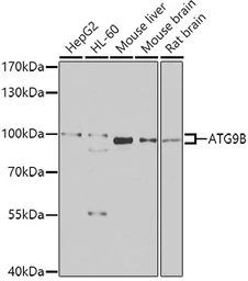 Anti-ATG9B antibody used in Western Blot (WB). GTX55524