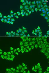 Anti-ATP synthase B1 antibody used in Immunocytochemistry/ Immunofluorescence (ICC/IF). GTX55525