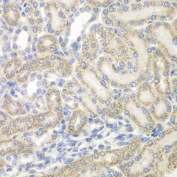 Anti-AUH antibody used in IHC (Paraffin sections) (IHC-P). GTX55527
