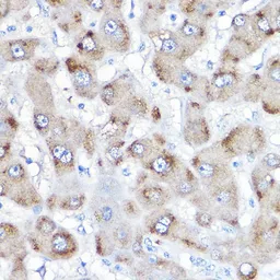 Anti-BAAT antibody used in IHC (Paraffin sections) (IHC-P). GTX55529