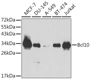 Anti-BCL10 antibody used in Western Blot (WB). GTX55533