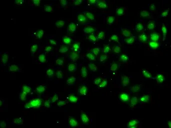 Anti-BCL6 antibody used in Immunocytochemistry/ Immunofluorescence (ICC/IF). GTX55534