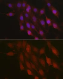 Anti-beta-TrCP antibody used in Immunocytochemistry/ Immunofluorescence (ICC/IF). GTX55536