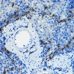 Anti-beta-TrCP antibody used in IHC (Paraffin sections) (IHC-P). GTX55536