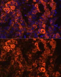 Anti-BHMT antibody used in IHC (Paraffin sections) (IHC-P). GTX55537