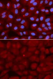 Anti-BIN1 antibody used in Immunocytochemistry/ Immunofluorescence (ICC/IF). GTX55538