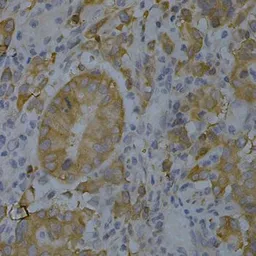 Anti-BIN1 antibody used in IHC (Paraffin sections) (IHC-P). GTX55538