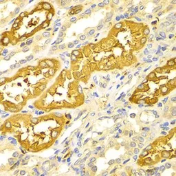 Anti-BIN1 antibody used in IHC (Paraffin sections) (IHC-P). GTX55538