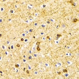 Anti-BIN1 antibody used in IHC (Paraffin sections) (IHC-P). GTX55538