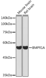 Anti-BMPR1A antibody used in Western Blot (WB). GTX55540