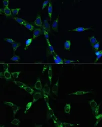 Anti-BUB1B antibody used in Immunocytochemistry/ Immunofluorescence (ICC/IF). GTX55541