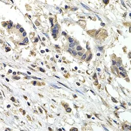 Anti-BUB1B antibody used in IHC (Paraffin sections) (IHC-P). GTX55541