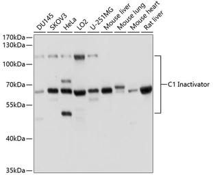 Anti-C1 inhibitor antibody used in Western Blot (WB). GTX55542