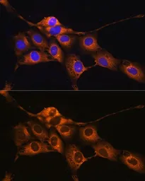 Anti-C1 inhibitor antibody used in Immunocytochemistry/ Immunofluorescence (ICC/IF). GTX55542
