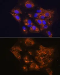 Anti-C1 inhibitor antibody used in Immunocytochemistry/ Immunofluorescence (ICC/IF). GTX55542