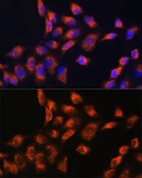 Anti-C1 inhibitor antibody used in Immunocytochemistry/ Immunofluorescence (ICC/IF). GTX55542