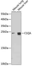 Anti-C1qA antibody used in Western Blot (WB). GTX55543