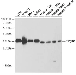 Anti-C1qBP antibody used in Western Blot (WB). GTX55544