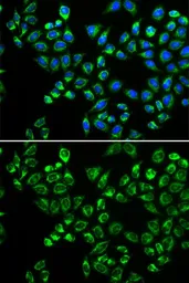 Anti-C1qBP antibody used in Immunocytochemistry/ Immunofluorescence (ICC/IF). GTX55544