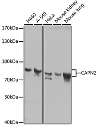 Anti-Calpain 2 antibody used in Western Blot (WB). GTX55545