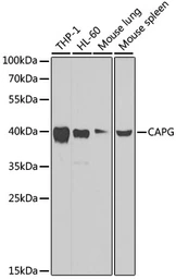 Anti-CAPG antibody used in Western Blot (WB). GTX55547