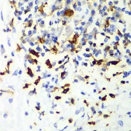 Anti-CAPG antibody used in IHC (Paraffin sections) (IHC-P). GTX55547