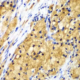 Anti-CAPG antibody used in IHC (Paraffin sections) (IHC-P). GTX55547
