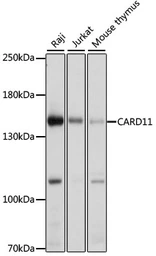 Anti-CARD11 antibody used in Western Blot (WB). GTX55548