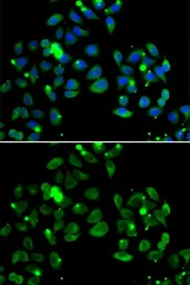 Anti-CARD11 antibody used in Immunocytochemistry/ Immunofluorescence (ICC/IF). GTX55548