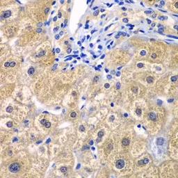 Anti-CARD11 antibody used in IHC (Paraffin sections) (IHC-P). GTX55548